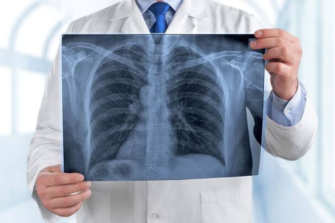 WhatsApp Image 2025-11-12 at 7.01.43 AM