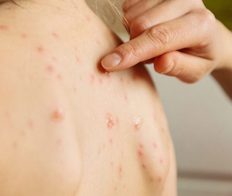 WhatsApp Image 2026-03-22 at 9.55.10 AM